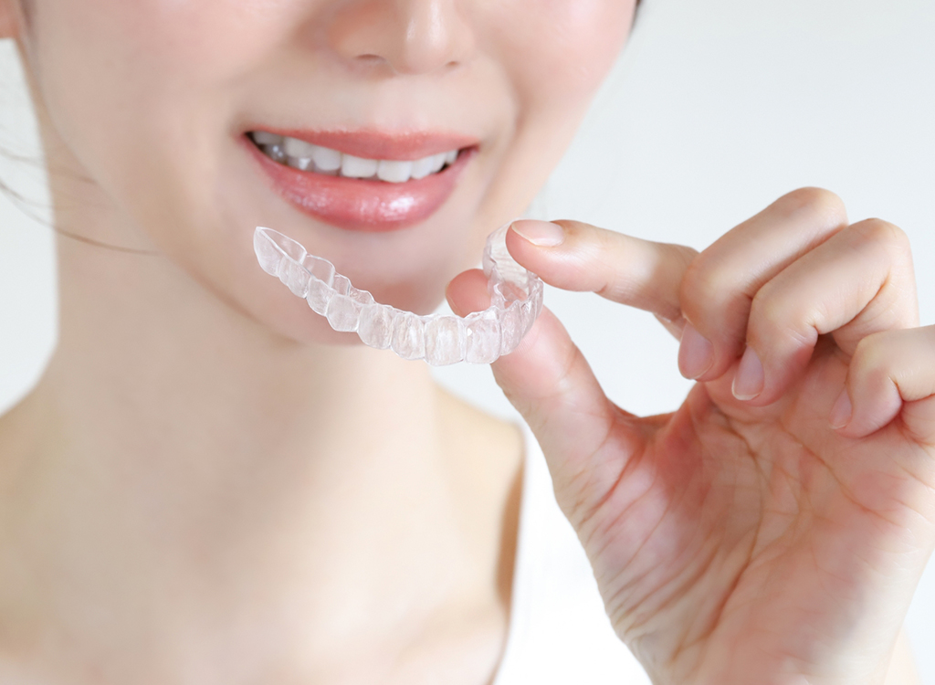 アライナー矯正